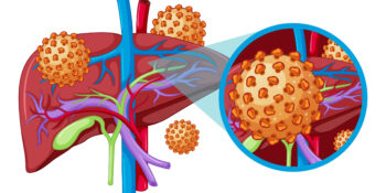 Hepatitis Specialist – Best in Delhi, UP & India