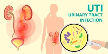 Urine Infection (UTI) Specialist – Best in Delhi, UP & India